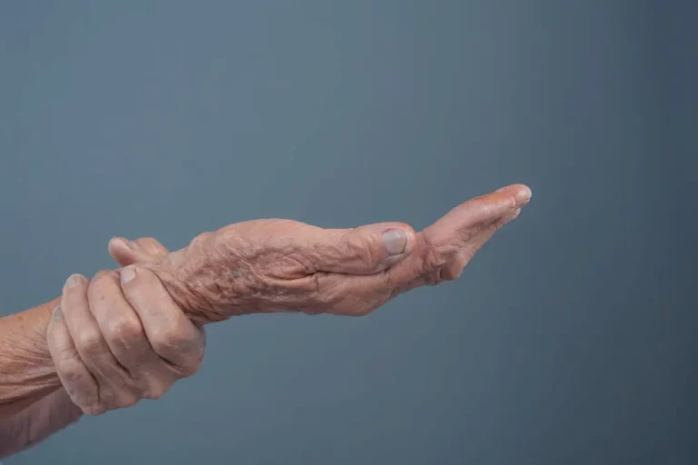 Artrit&iacute;da zapr&iacute;činen&aacute; meningokokmi: Neviditeľn&yacute; nepriateľ r&uacute;k