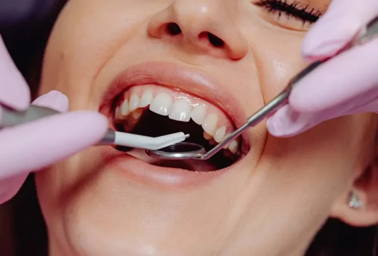 Najčastejšie mýty o bielení zubov